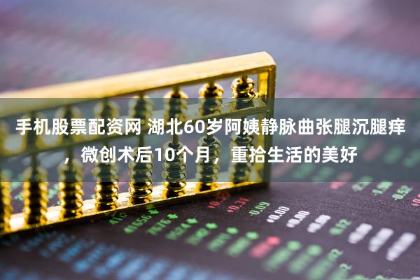 手机股票配资网 湖北60岁阿姨静脉曲张腿沉腿痒，微创术后10个月，重拾生活的美好